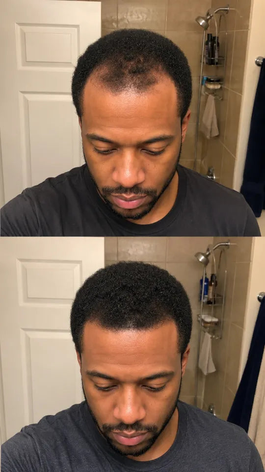 Before and after hair serum routine progress photo