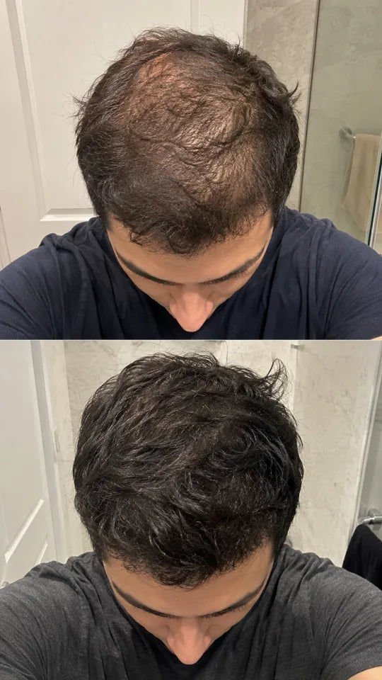 Before and after hair styling progress photo after using peptide hair serum