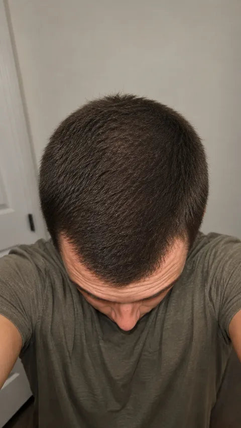 Marcus after consistent use of peptide hair serum