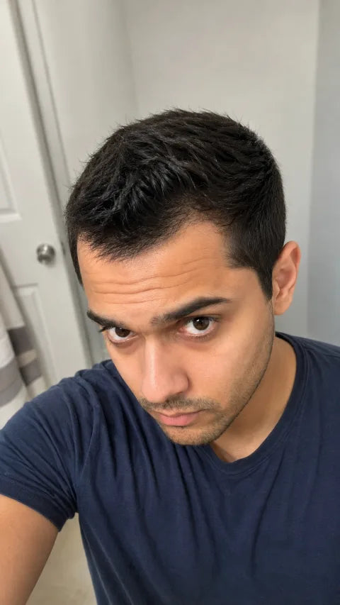 Ryan after consistent use of peptide hair serum around the temples